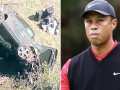 Tiger Woods nhập viện vì tai nạn xe nghiêm trọng