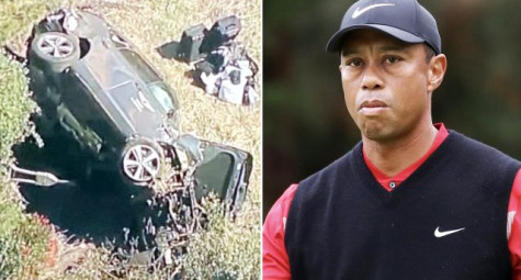 Tiger Woods nhập viện vì tai nạn xe nghiêm trọng