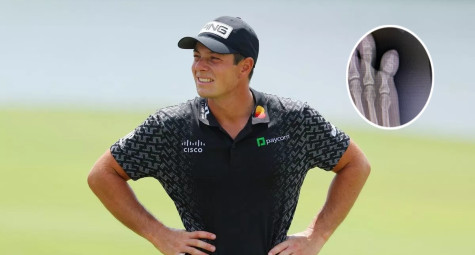 Viktor Hovland gặp chấn thương “kỳ quặc” trong dịp nghỉ lễ