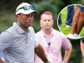Cận cảnh chấn thương chân phải của Tiger Woods được tiết lộ