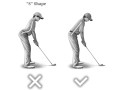 Dáng chữ “S” và nghiêng xương chậu 