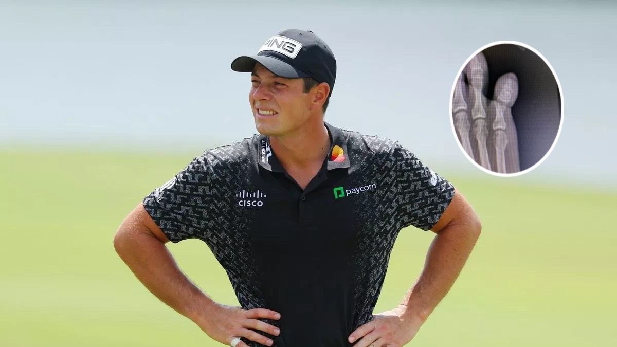 Viktor Hovland gặp chấn thương “kỳ quặc” trong dịp nghỉ lễ